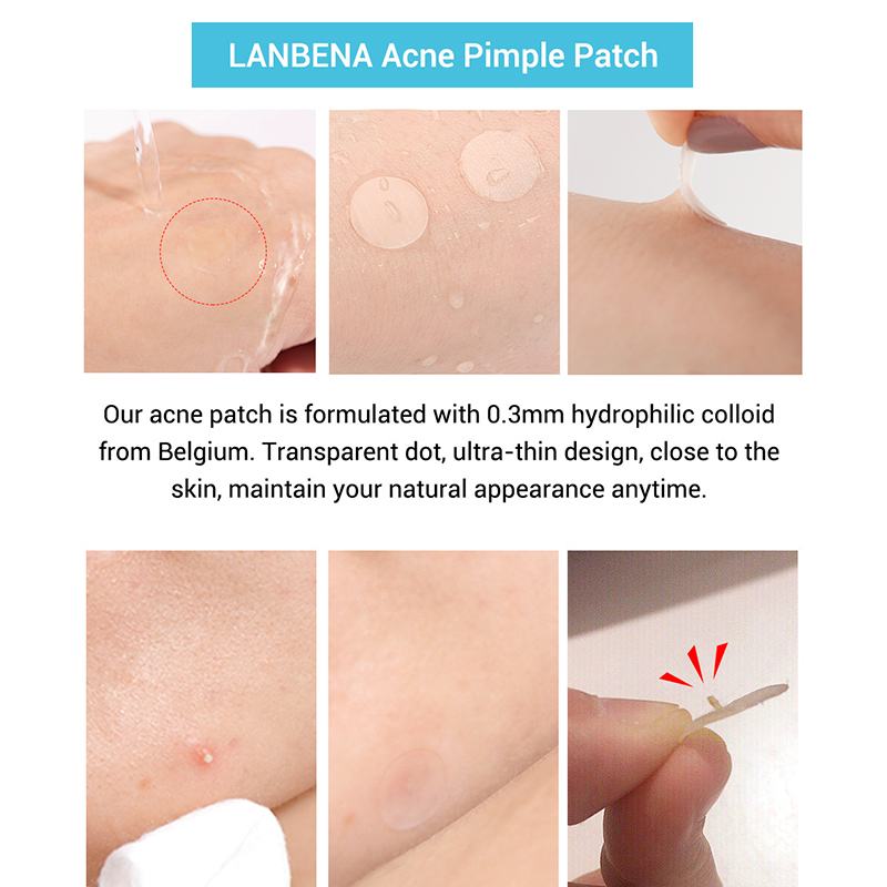 Invisible Acne Blemish Patches